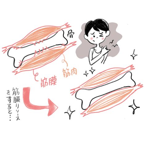 筋膜リリース