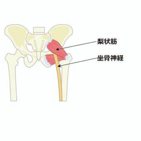 梨状筋