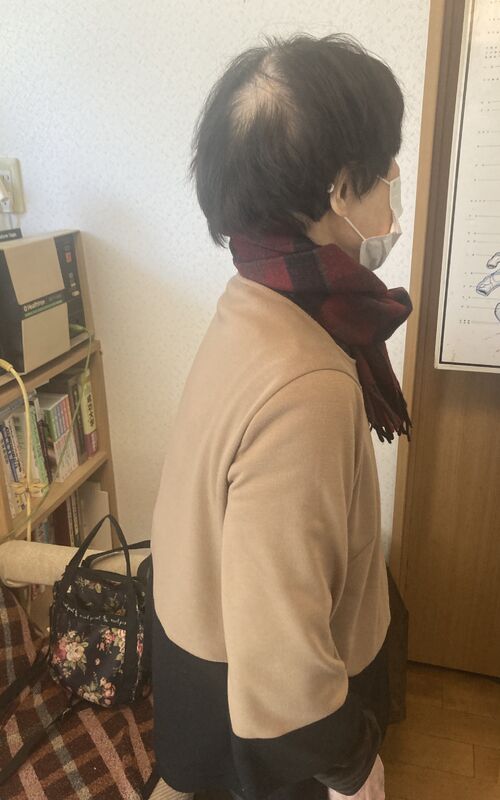 施術前