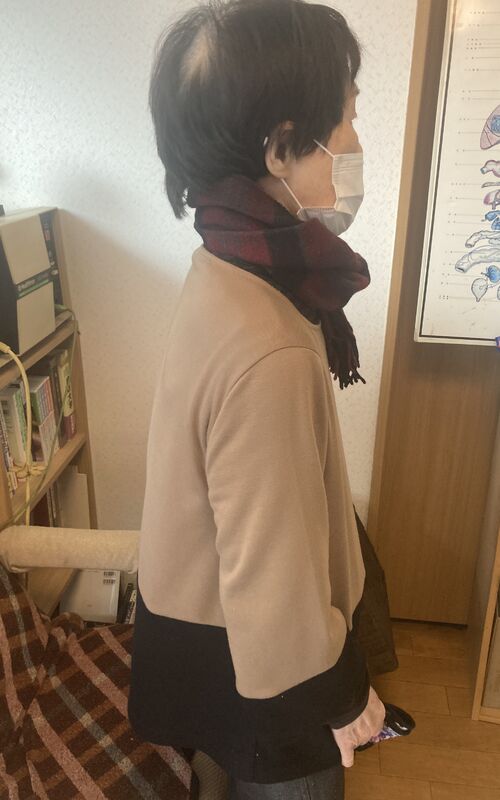 施術後